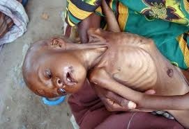 المجاعة فى الصومال ‎ Download?action=showthumb&id=35