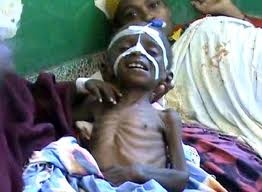 المجاعة فى الصومال ‎ Download?action=showthumb&id=36