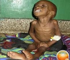 المجاعة فى الصومال ‎ Download?action=showthumb&id=38