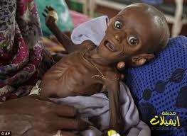 المجاعة فى الصومال ‎ Download?action=showthumb&id=41